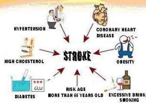 Faktor utama penyebab stroke